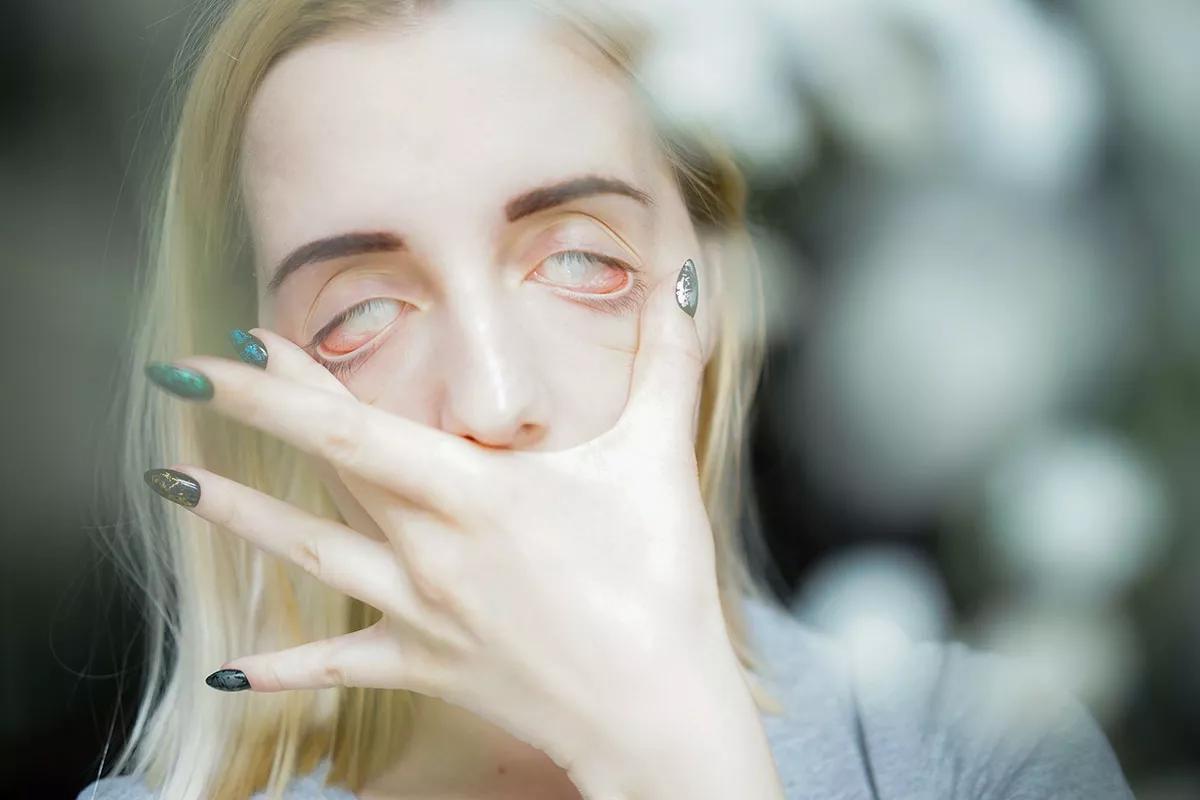 El modo "zombie" después de consumir marihuana es más común de lo que parece. || Imagen: Canamo.net